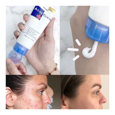 MisLine Acne Clear Facial Foam Facewash